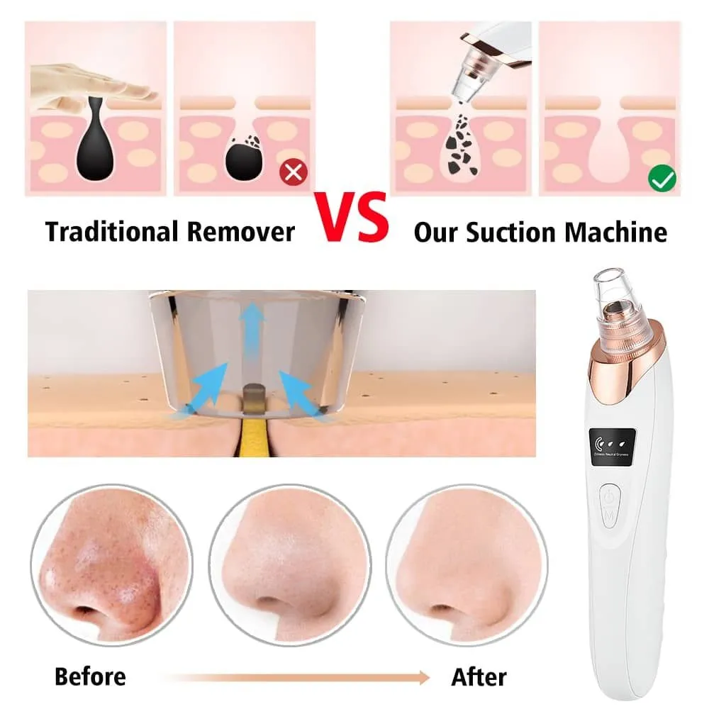 Premium Electric Blackhead Remover Vacuum | Face Vacuum Pore Cleanser-5 Suction Probes