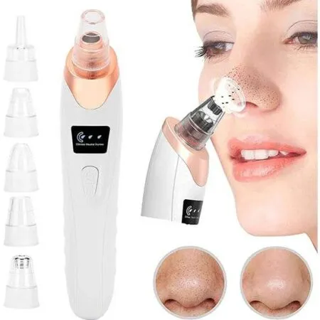 Premium Electric Blackhead Remover Vacuum | Face Vacuum Pore Cleanser-5 Suction Probes